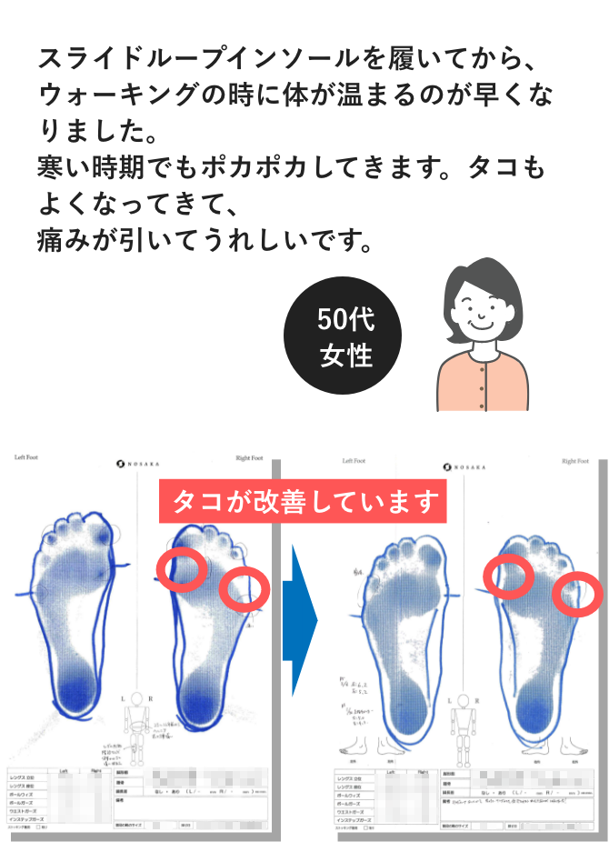 スライドループインソールを履いてから、ウォーキングの時に体が温まるのが早くなりました。寒い時期でもポカポカしてきます。タコもよくなってきて、痛みが引いてうれしいです。