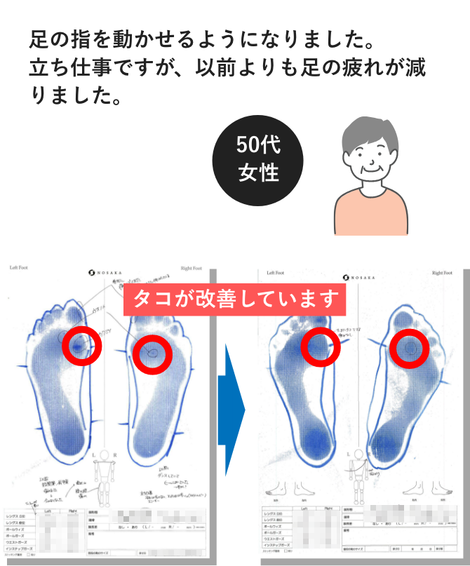 足の指を動かせるようになりました。 立ち仕事ですが、以前よりも足の疲れが減りました。